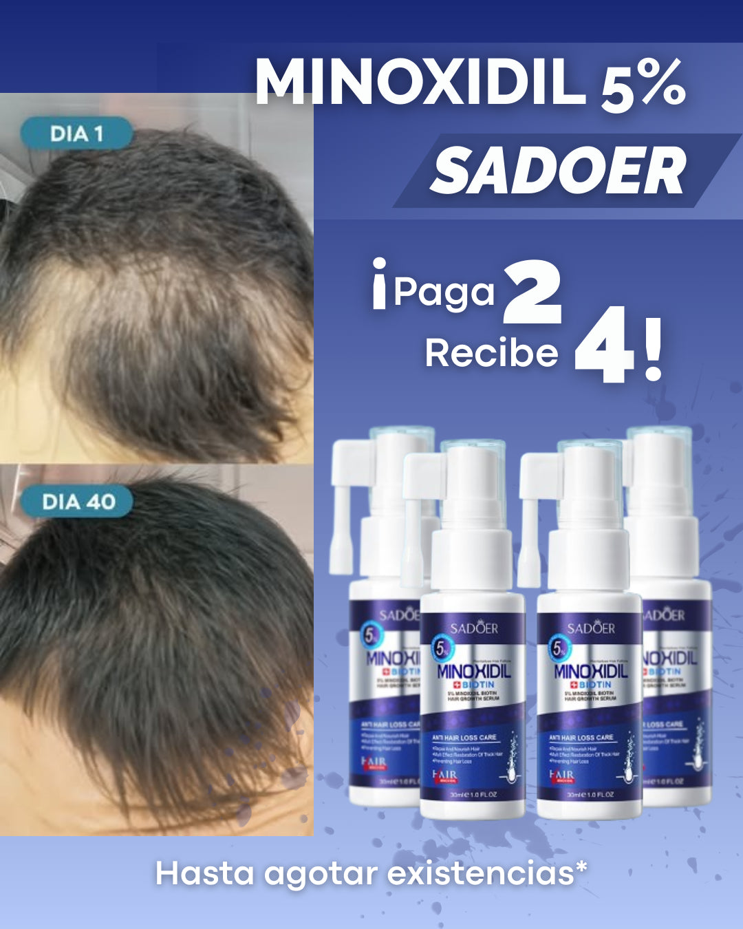 Minoxidil SADOER ¡PROMOCIÓN 4X2!